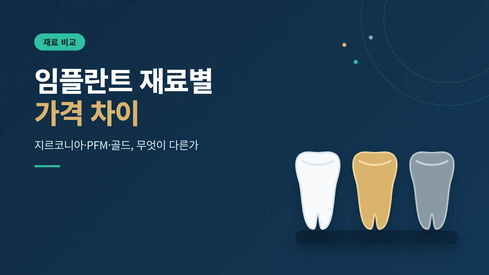 임플란트 재료별 가격 차이