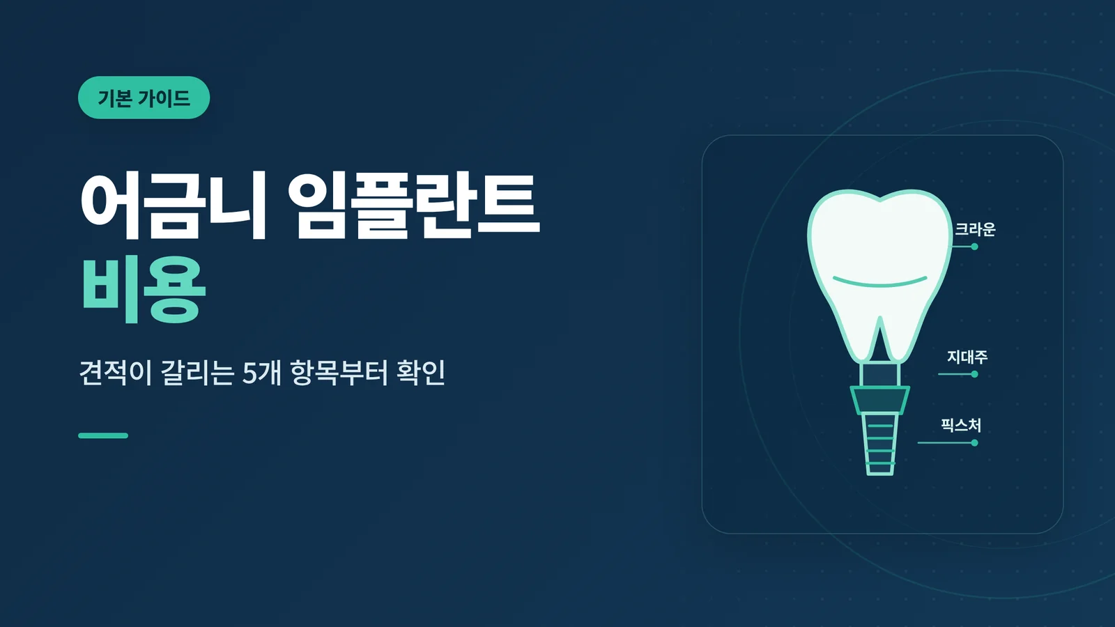 어금니 임플란트 비용 안내 썸네일
